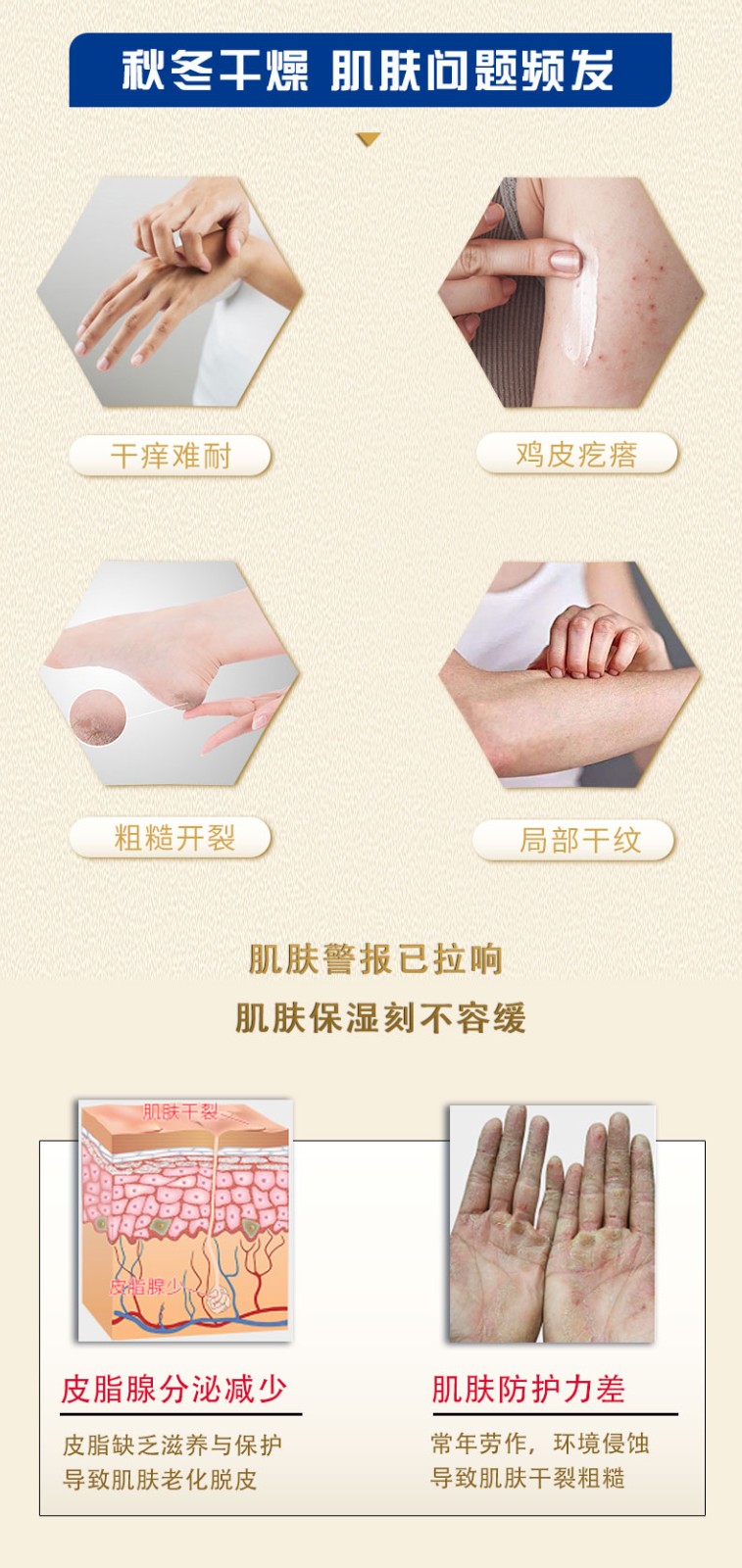 尿素霜详情页12_03.jpg