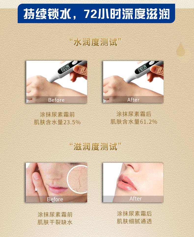 尿素霜详情页12_06.jpg